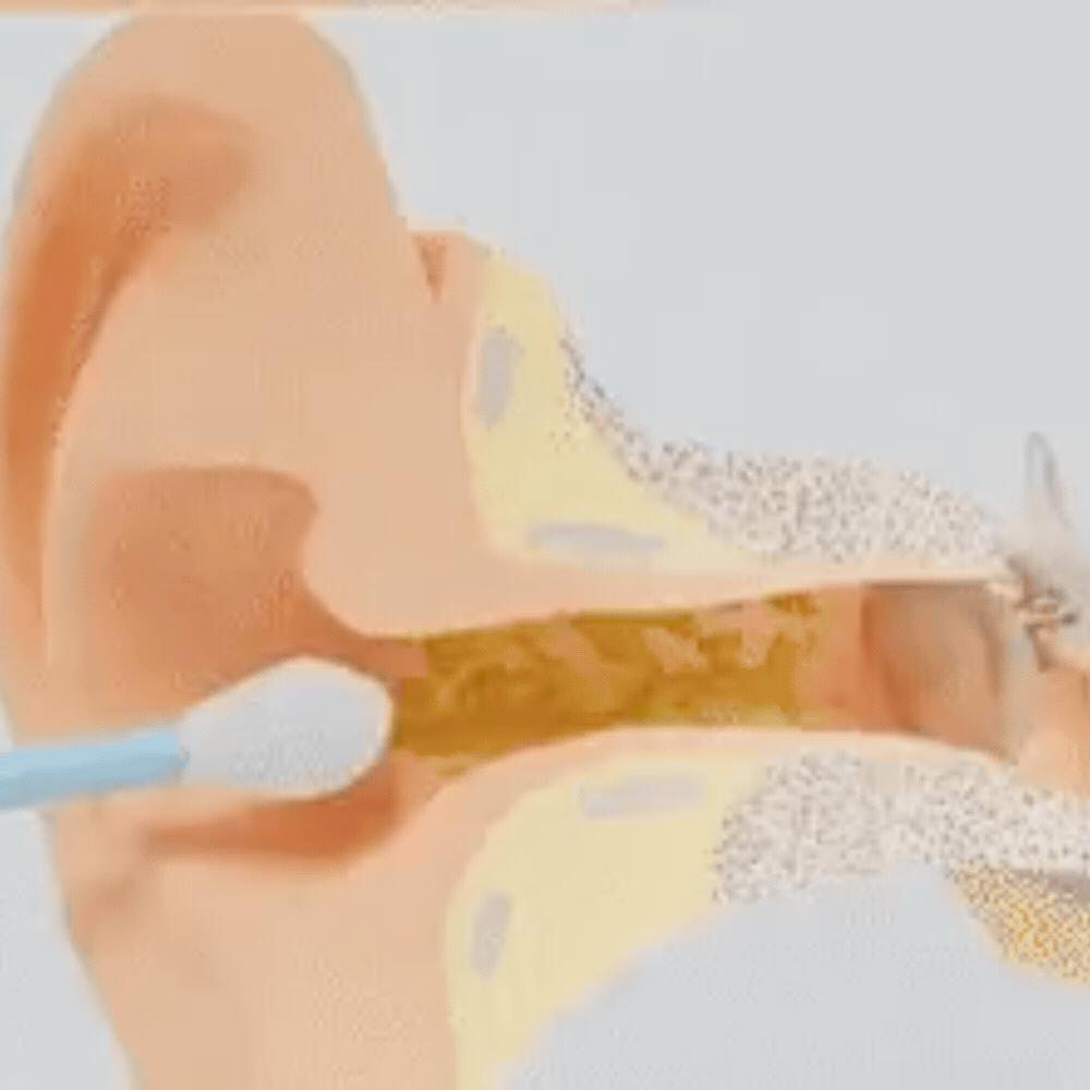 Serevia™ – Pulizia auricolare slim con tecnologia avanzata